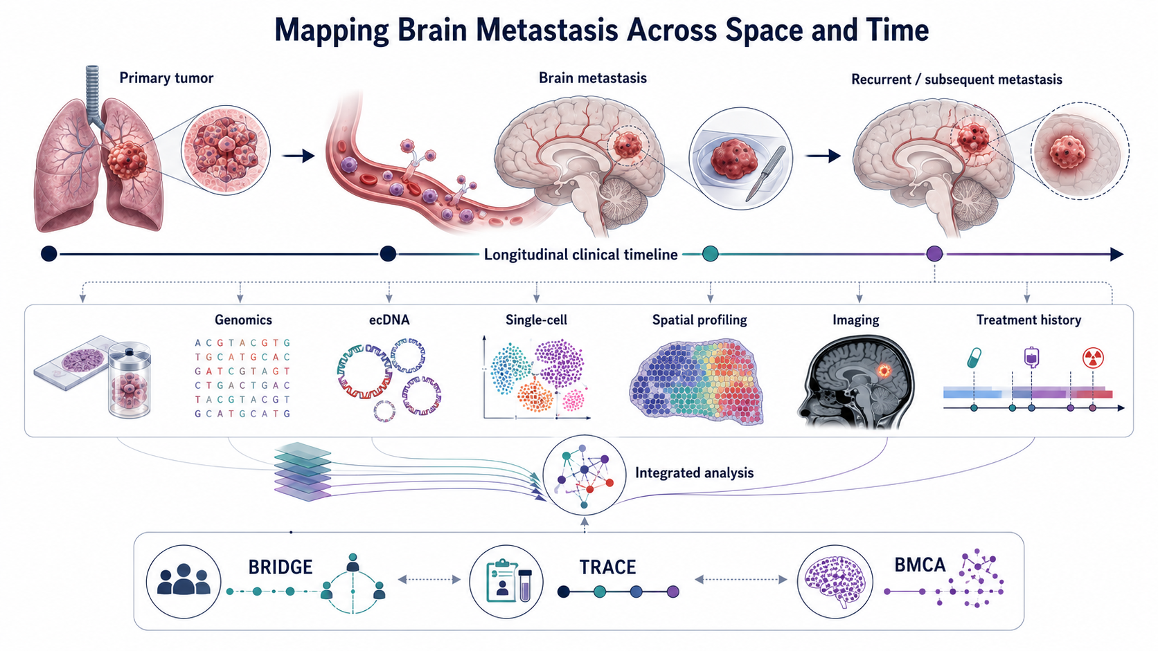 Longitudinal schematic from a primary tumor through brain metastasis and later recurrence, integrating genomics, ecDNA, single-cell and spatial profiling, imaging, and treatment history.