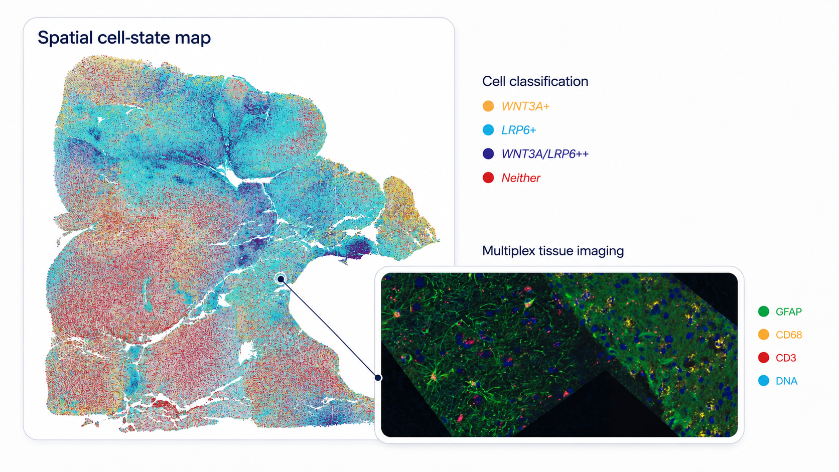 Spatial cell-state map of glioblastoma classified by WNT3A and LRP6 expression, linked to a multiplex tissue-imaging inset showing GFAP, CD68, CD3, and DNA.