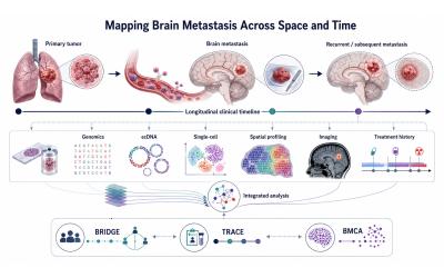 Infographic depicting the longitudinal integration of primary tumors, brain metastases, clinical timelines, and multimodal profiling maps metastatic evolution across space and time.
